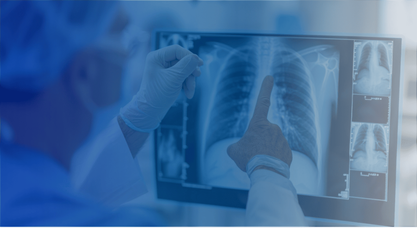 Chest X-Ray Automation