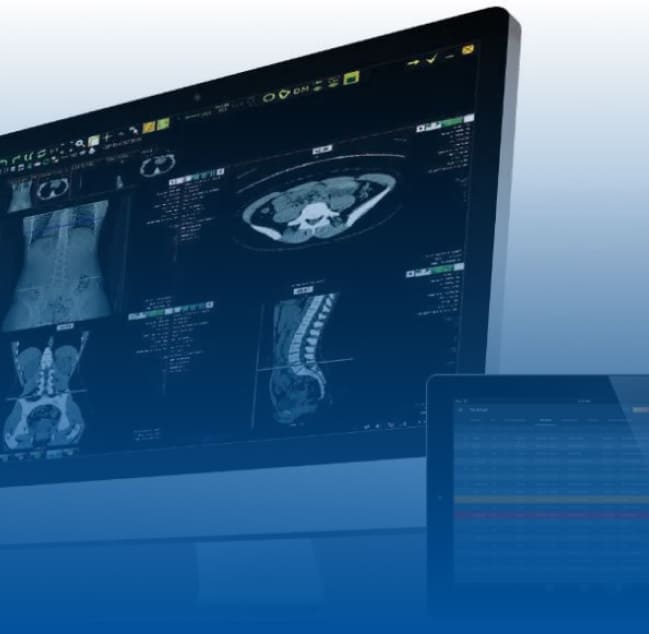 Augmento - A Cloud PACS with AI based Pathology Prediction and Structured Reporting