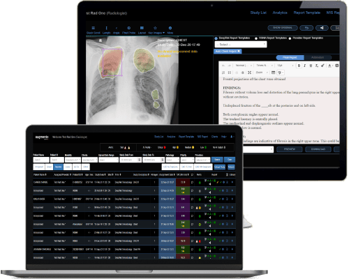 XRay, CT and MRI reporting productivity boost with Augmento Enterprise 